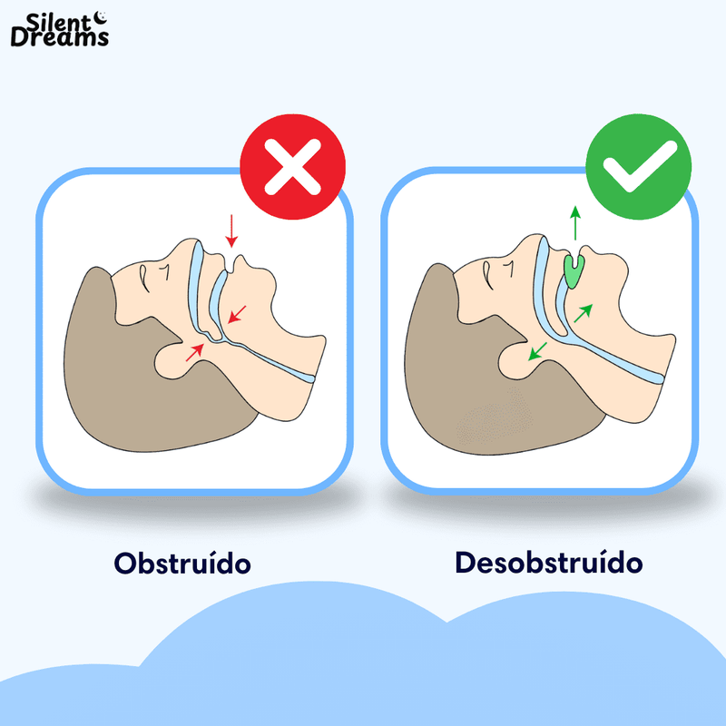 Silent PRO anti ronco® COMPRE 1 E LEVE 3